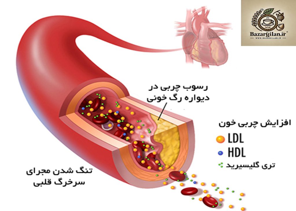 برای کاهش سریع چربی خون چی بخوریم؟